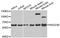 RAD23 Homolog B, Nucleotide Excision Repair Protein antibody, STJ29836, St John
