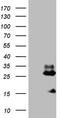 NADH:Ubiquinone Oxidoreductase Subunit B11 antibody, TA807596S, Origene, Western Blot image 