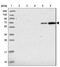 Zinc Finger SWIM-Type Containing 1 antibody, NBP2-13607, Novus Biologicals, Western Blot image 
