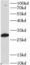 Protein Phosphatase 1 Catalytic Subunit Beta antibody, FNab10320, FineTest, Western Blot image 