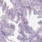 Autoimmunogenic cancer/testis antigen NY-ESO-2 antibody, PA5-64462, Invitrogen Antibodies, Immunohistochemistry frozen image 