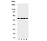 Matrilin 3 antibody, R31027, NSJ Bioreagents, Western Blot image 