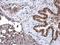 Deoxycytidine Kinase antibody, NBP2-16108, Novus Biologicals, Immunohistochemistry paraffin image 