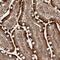 Cell Cycle Progression 1 antibody, PA5-55443, Invitrogen Antibodies, Immunohistochemistry paraffin image 