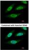 Casein kinase II subunit beta antibody, NBP2-21570, Novus Biologicals, Immunocytochemistry image 