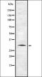 Putative taste receptor type 2 member 12 antibody, orb336451, Biorbyt, Western Blot image 
