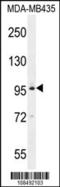 Bromodomain Testis Associated antibody, MBS9205210, MyBioSource, Western Blot image 