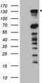Poly(ADP-ribose) glycohydrolase antibody, TA808515S, Origene, Western Blot image 