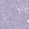 MORC Family CW-Type Zinc Finger 4 antibody, HPA000395, Atlas Antibodies, Immunohistochemistry paraffin image 