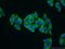 Methionyl-TRNA Synthetase antibody, 14829-1-AP, Proteintech Group, Immunofluorescence image 