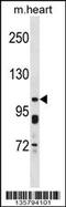 Potassium Voltage-Gated Channel Subfamily Q Member 5 antibody, 58-714, ProSci, Western Blot image 