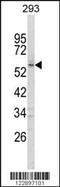 Forkhead Box C1 antibody, 63-697, ProSci, Western Blot image 