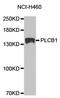 Phospholipase C Beta 1 antibody, TA327224, Origene, Western Blot image 