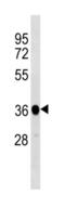 Protein Phosphatase 1 Catalytic Subunit Beta antibody, abx034764, Abbexa, Western Blot image 