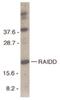 CASP2 And RIPK1 Domain Containing Adaptor With Death Domain antibody, PA5-19865, Invitrogen Antibodies, Western Blot image 