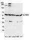 Ribosomal Protein S6 Kinase B2 antibody, A300-576A, Bethyl Labs, Western Blot image 