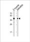 Alpha-2Db adrenergic receptor antibody, PA5-72214, Invitrogen Antibodies, Western Blot image 