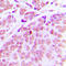 Centrosomal protein of 70 kDa antibody, LS-C354204, Lifespan Biosciences, Immunohistochemistry frozen image 