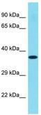 FYN Binding Protein 2 antibody, TA334801, Origene, Western Blot image 