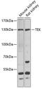 TEK Receptor Tyrosine Kinase antibody, 22-794, ProSci, Western Blot image 