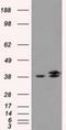 Isocitrate Dehydrogenase (NAD(+)) 3 Alpha antibody, NBP2-02158, Novus Biologicals, Western Blot image 