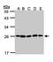 Proteasome 20S alpha 2 antibody, NBP1-31542, Novus Biologicals, Western Blot image 