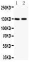 C-C Motif Chemokine Ligand 26 antibody, PB9120, Boster Biological Technology, Western Blot image 