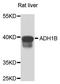 Alcohol Dehydrogenase 1B (Class I), Beta Polypeptide antibody, orb135010, Biorbyt, Western Blot image 