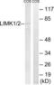 LIM domain kinase 1 antibody, LS-C199200, Lifespan Biosciences, Western Blot image 