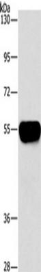 Alpha 2-HS Glycoprotein antibody, TA349461, Origene, Western Blot image 