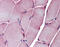 Sarcoglycan Epsilon antibody, ARP46387_P050, Aviva Systems Biology, Immunohistochemistry paraffin image 