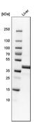 Ornithine Carbamoyltransferase antibody, HPA000243, Atlas Antibodies, Western Blot image 