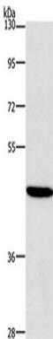 Histone deacetylase 8 antibody, TA349342, Origene, Western Blot image 