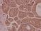ICER antibody, A04379, Boster Biological Technology, Immunohistochemistry paraffin image 