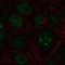 Zinc Finger And BTB Domain Containing 14 antibody, HPA070819, Atlas Antibodies, Immunocytochemistry image 