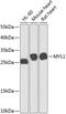 Myosin light chain 1/3, skeletal muscle isoform antibody, A08789, Boster Biological Technology, Western Blot image 