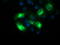 Sequestosome-1 antibody, CF502239, Origene, Immunofluorescence image 