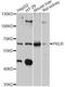 Pyruvate Kinase L/R antibody, LS-C747453, Lifespan Biosciences, Western Blot image 