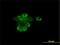 RAR-alpha antibody, H00005914-M01, Novus Biologicals, Immunocytochemistry image 