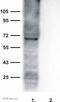 Bestrophin-1 antibody, ab14927, Abcam, Western Blot image 