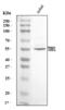 Telomeric Repeat Binding Factor 1 antibody, A02474-2, Boster Biological Technology, Western Blot image 