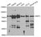 Matrix Metallopeptidase 2 antibody, TA332987, Origene, Western Blot image 