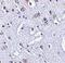TP53 Induced Glycolysis Regulatory Phosphatase antibody, PA5-20347, Invitrogen Antibodies, Immunohistochemistry frozen image 