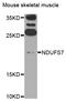 NADH:Ubiquinone Oxidoreductase Core Subunit S7 antibody, STJ110172, St John