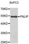 Pancreatic Lipase antibody, A7421, ABclonal Technology, Western Blot image 