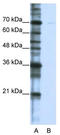 Cleavage Stimulation Factor Subunit 2 Tau Variant antibody, TA343826, Origene, Western Blot image 