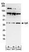 MAPK Activated Protein Kinase 3 antibody, A304-305A, Bethyl Labs, Western Blot image 