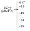 Protein Kinase C Zeta antibody, AP01667PU-N, Origene, Western Blot image 