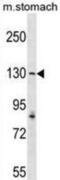 Cytosolic carboxypeptidase 1 antibody, abx029618, Abbexa, Western Blot image 