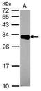 2,4-Dienoyl-CoA Reductase 2 antibody, PA5-30503, Invitrogen Antibodies, Western Blot image 